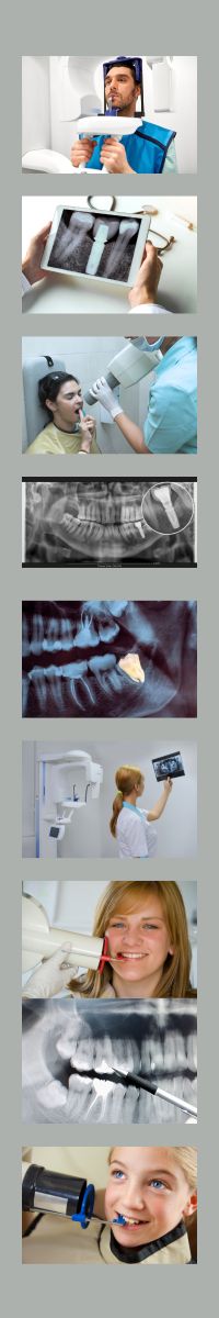 radiografias dentales